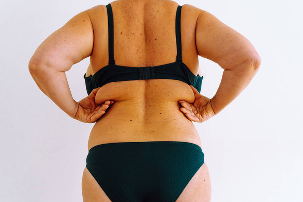 unrecognizable stout middle aged woman 40s, green bikini, obese, with excess skin hanging from flabby, unstretched back. Big size. Holding waist flaccid, visceral, cellulite. imperfection of skin, senile age-related changes - Foto, Imagem