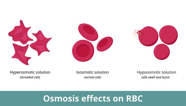 Osmosis effect on red blood cells. Depending on solution concentration (hyperosmotic, isosmotic, or hypoosmotic), erythrocytes can shrivel or swell and burst. - Вектор,изображение