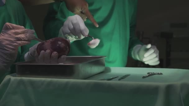 Surgeon team specialist surgery transplant heart with patient for rescue while emergency in the operating room at hospital, cardiology and disease cardiovascular, medical and insurance concept. - Filmmaterial, Video