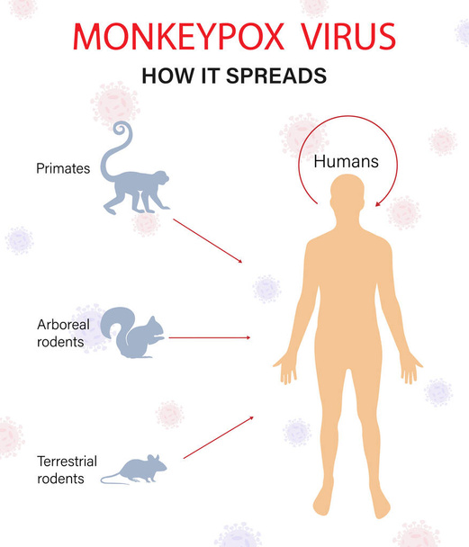 Infographics of the spread of monkeypox disease. Flat vector illustration. - Vetor, Imagem