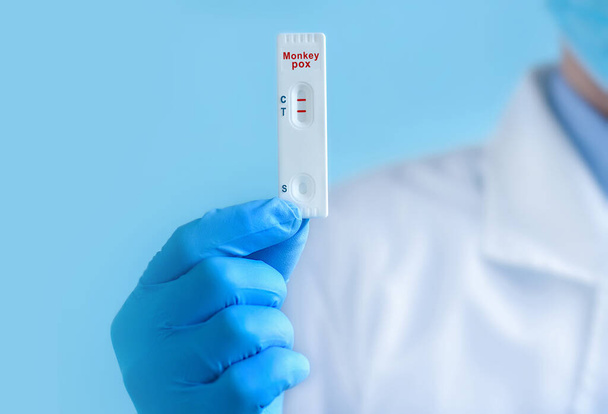 Un médecin ou une infirmière portant un masque protecteur et des gants montre un test de laboratoire rapide pour le virus de la variole du singe express (MPXV) afin de détecter les anticorps IgM et IgG contre le nouveau coronavirus. Résultat positif - Photo, image