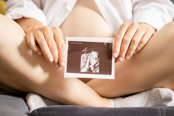 Pregnant woman holding ultrasound image of her baby sitting on the bed. Closeup view. Concept of pregnancy and parenting. - 写真・画像