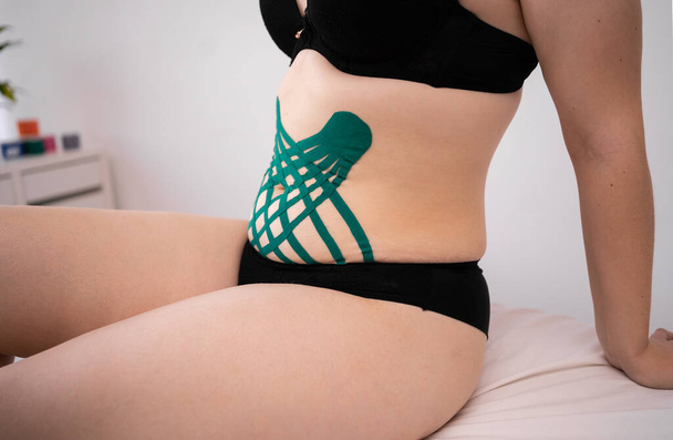 Kinesiology taping.applying kinesiology tape to patient belly.Anti-cellulite procedure for slim tummy.Weight loss concept. - Fotoğraf, Görsel