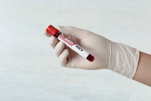 Scientist holding tube with blood sample and label ANTI HEV on light background, closeup - Foto, Imagen