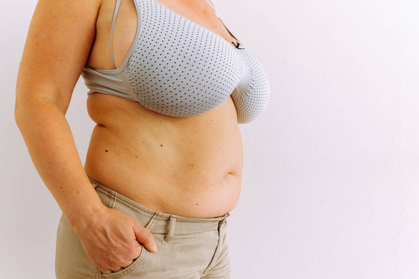 Κοντινό πλάνο υπέρβαρη μεσήλικη σαραντάρα χοντρή γυναίκα που δείχνει πλαδαρό δέρμα στην κοιλιά με περίσσεια λίπους, φορώντας σορτς σουτιέν. Κρεμασμένη κοιλιά. συνέπειες ανθυγιεινή διατροφή, αδράνεια, έλλειψη αντλείται μυς. - Φωτογραφία, εικόνα