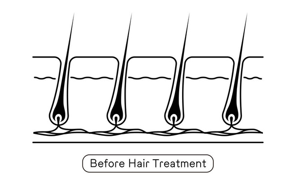 Image of hair removal, before and untreated hair - ベクター画像