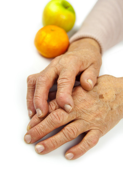 Artrite reumatoide mãos e frutos
 - Foto, Imagem