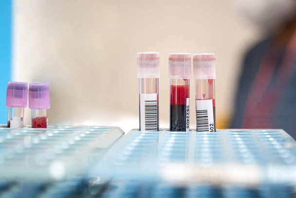 Blood sample in tubes, collected from patients. Close up view. - Foto, Imagem