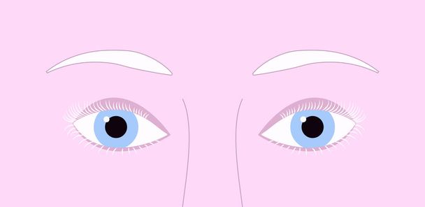 Closeup light blue eyes of albino person with pink skin and white depigmented eyelash and eyebrows. Vector illustration - Vector, Imagen