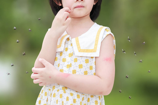 Little girl has skin rash allergy itching and scratching on her arm with mosquitoes bite - Valokuva, kuva