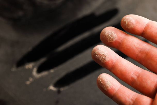 caucasian hand with dust on finger tips after touching black dusty surface, closeup with selective focus - Foto, Bild
