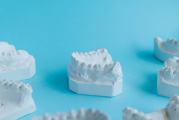 Μοντέλο γύψου δοντιών. Στοματολογικά γύψινα καλούπια από ανθρώπινα σαγόνια σε μπλε φόντο. Οδοντιατρική και ορθοδοντική έννοια - Φωτογραφία, εικόνα