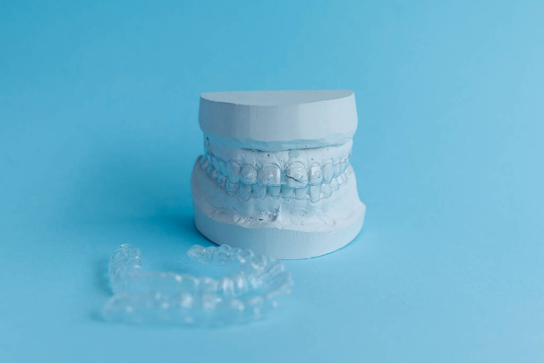 Plaster human jaw model and essix retainer for dental correction - 写真・画像