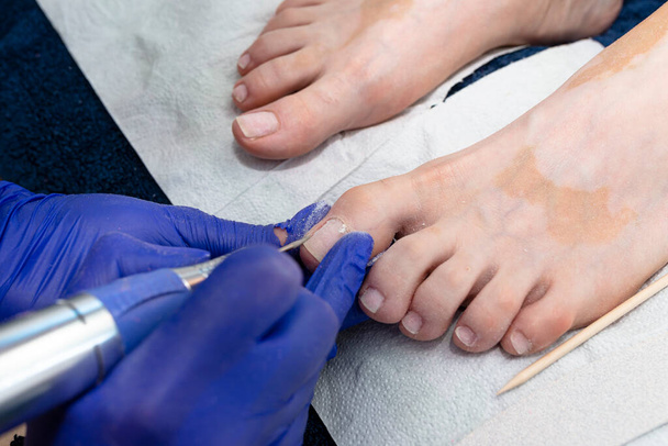 A manicurist cuts the cuticles of toenails with an electric milling machine wearing blue latex gloves. - Valokuva, kuva