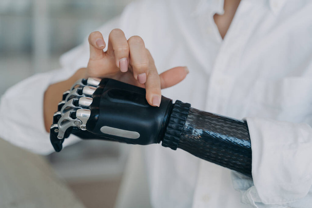 Hands of handicapped girl. Disabled young woman is setting bionic limb. Cyber prosthesis hand has processor chip, software and buttons. European girl has cybernetic carbon hand. - Foto, Imagen