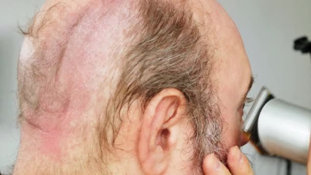 Man shaves his head. Amateur haircut in the bathroom. An overgrown man with a bald patch clumsily cuts his brown gray hair on his head with an electric clipper. Self shaving head with a trimmer  - Metraje, vídeo