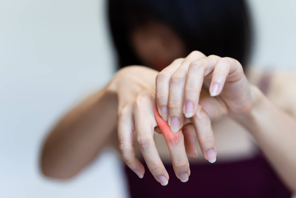 Woman has pain in her knuckle due to rheumatoid arthritis. - 写真・画像