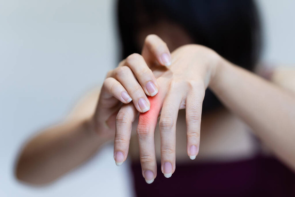 Woman's knuckle pain, Signs of osteoarthritis. - 写真・画像