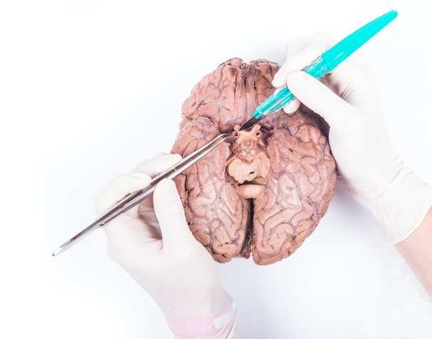 human brain dissection - Foto, Imagen