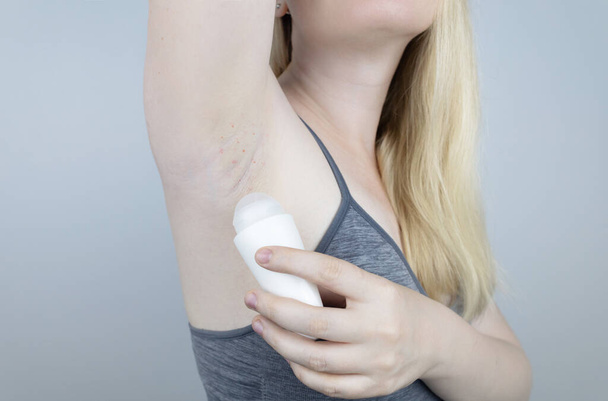 Armpit rash. Underarm skin irritation. Blonde girl shows irritation on the skin after using a razor, trimmer, deodorant or antiperspirant. Allergy or irritation. Acne or red spots - 写真・画像