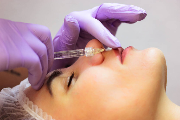 Lip augmentation procedure. Patient woman getting filler botox injection. Beautician injects collagen, hyaluronic acid, silicone through a syringe. Cosmetologist wearing purple gloves. Working process - Photo, Image