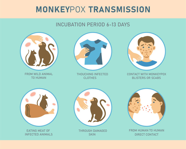 Monkeypox virus transmission infographics with icons. Vector flat illustration for medical concept. Design for banner, poster, flyer. - Vetor, Imagem