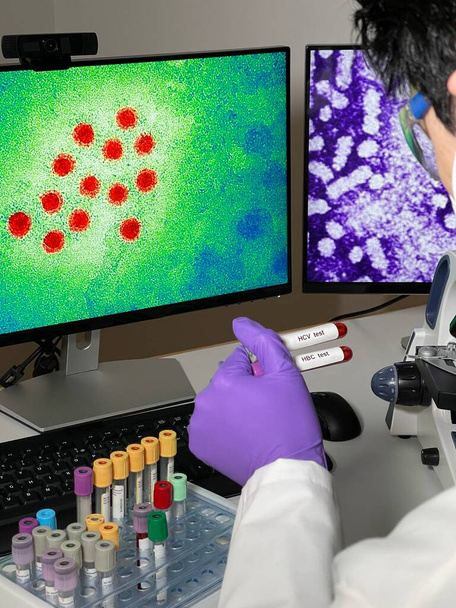 Лаборатория проводит исследования с изображениями вирусов гепатита А и В на компьютере. - Фото, изображение