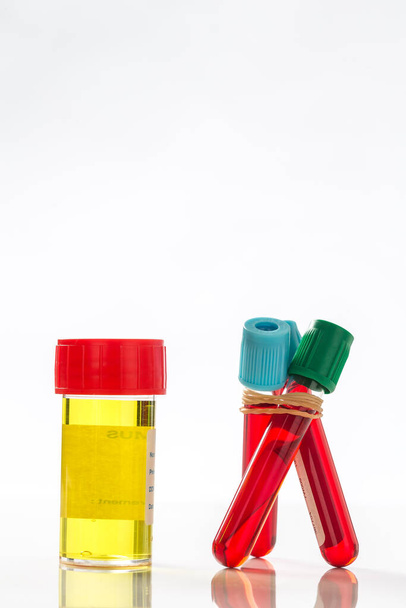 Blood and urine samples. - Photo, image