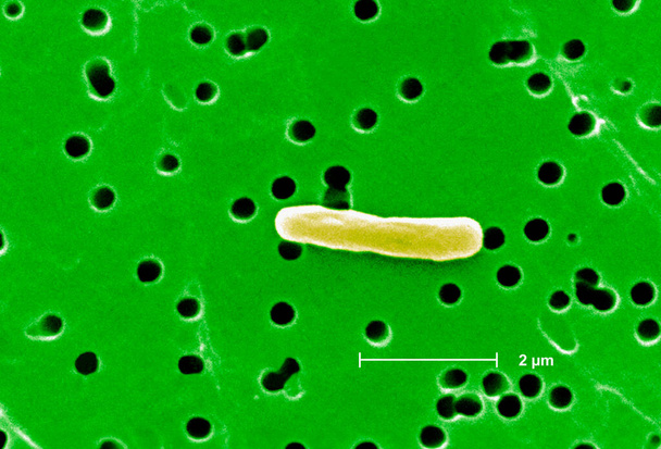 Αυτή η μικρογραφία ηλεκτρονίων σάρωσης (SEM) απεικονίζει μια εξαιρετικά μεγεθυμένη άποψη ενός βακτηρίου Escherichia coli σε σχήμα ράβδου. Μεγέθυνση 12800x. Escherichia coli είναι ένα Gram-αρνητικό βακτήριο που συνήθως αποικίζει το πεπτικό σύστημα των πιο θερμόαιμων α - Φωτογραφία, εικόνα