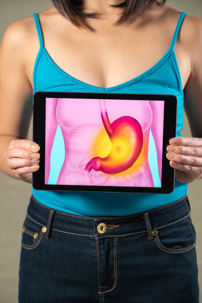 Woman holding screen with drawing of stomach and gastric ulcer - Foto, immagini