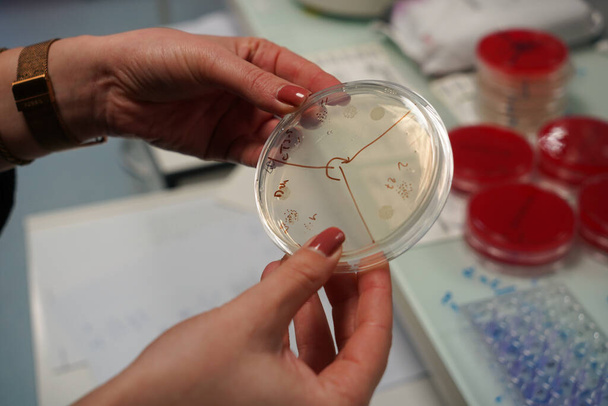 Research on chronic bacterial infections within Inserm. Student working on bacteriological infections. - Foto, Bild