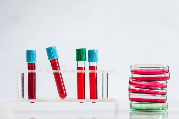 Blood samples and Petri dishes. - 写真・画像