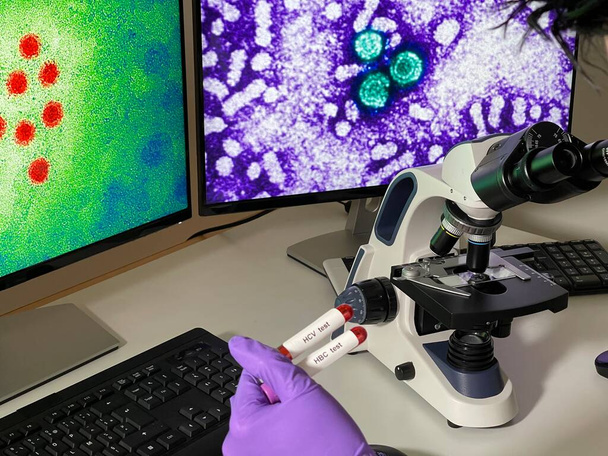 Βοηθός εργαστηρίου που κάνει έρευνα με εικόνες του ιού της ηπατίτιδας Α και Β στον υπολογιστή. - Φωτογραφία, εικόνα