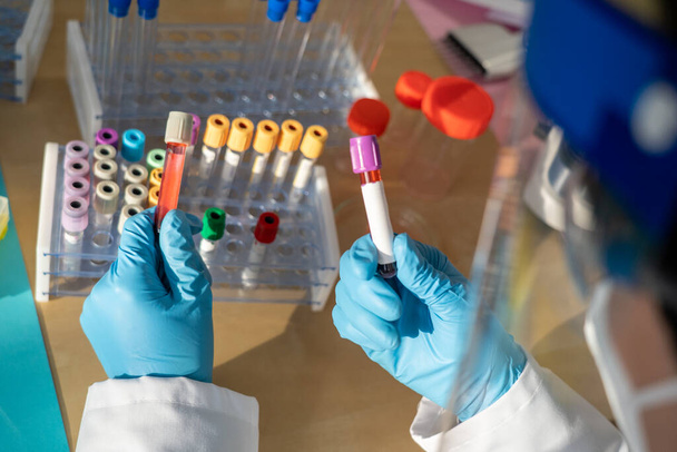 Laboratory technician performing blood tests in the laboratory. - Zdjęcie, obraz