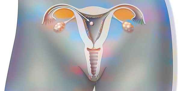 Anatomy of the female genital tract: implantation of the embryo. - 写真・画像