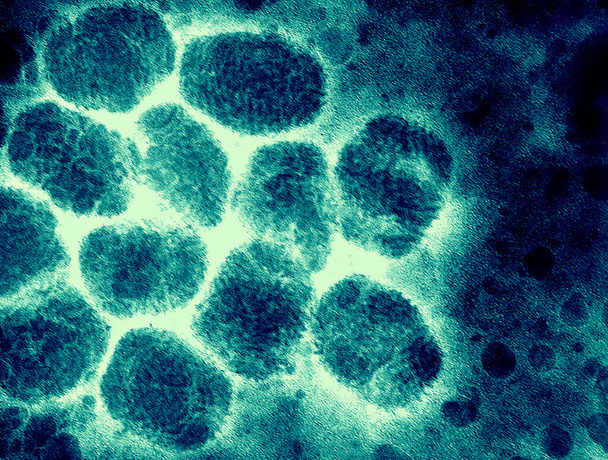 A transmission electron micrograph of smallpox viruses. Smallpox is a serious, highly contagious, and sometimes fatal infectious disease. There is no specific treatment for smallpox disease, and the only prevention is vaccination. - Foto, Bild