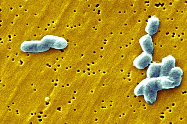 Этот сканирующий электронный микрограф (СЭМ) изображает ряд высоко увеличенных палочкообразных, подвижных, грамотрицательных инфантильных бактерий сальмонеллы, некоторые из которых прикреплены; Увеличение 11614x. Salmonella infantis действительно является одним из Salmonella spp. pa - Фото, изображение