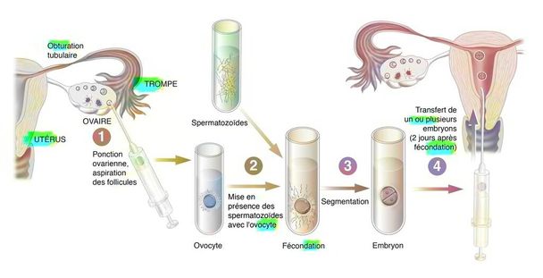 Diagram of the different stages of in vitro fertilization. - Foto, afbeelding