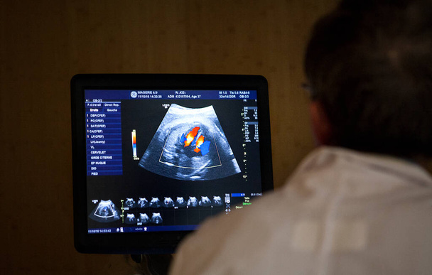 A doctor radiologist performs an ultrasound of the third trimester, the blood flow can be observed. - Fotografie, Obrázek