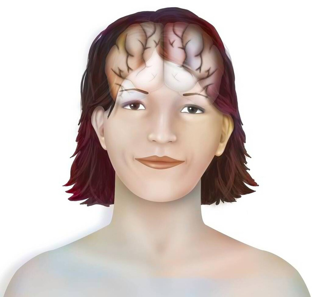 Мозок (права і ліва півкулі головного мозку) в обличчі жінки.. - Фото, зображення