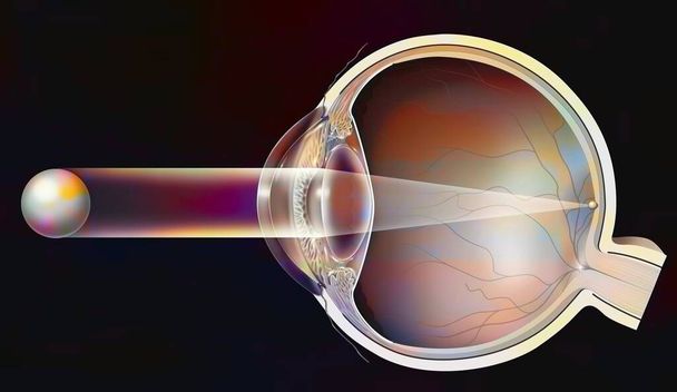 Normal vision in a healthy eye: the image forms on the retina. - Fotografie, Obrázek