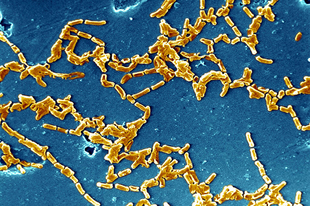 Micrographie électronique à balayage de Mycobacterium chelonae
. - Photo, image