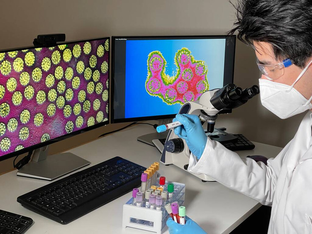 Laboratory assistant doing research with papillomavirus images on a computer. - 写真・画像