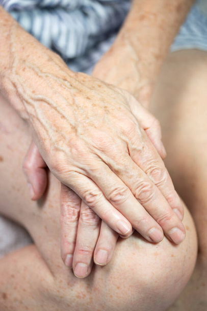 Hands with spots of old age - Foto, Imagem