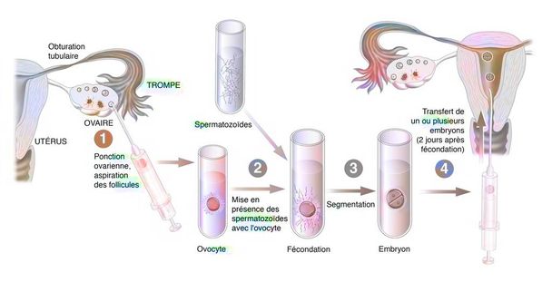 Diagram of the different stages of in vitro fertilization. - Photo, Image