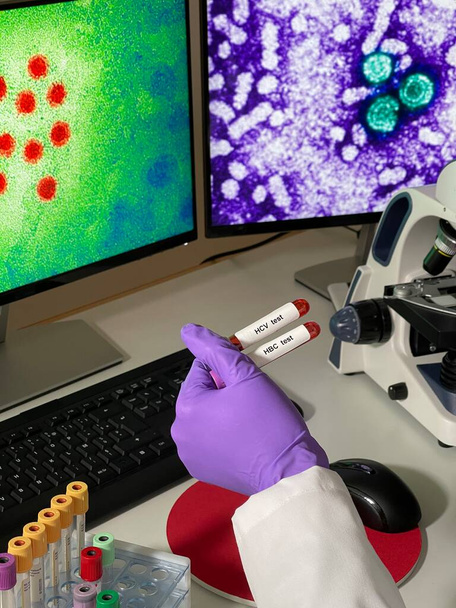 Laboratory assistant doing research with images of hepatitis A and B virus on computer. - Photo, Image