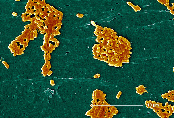 This scanning electron micrograph (SEM) depicts a number of rod-shaped Escherichia coli bacterium, some of which have formed colonial groupings, while others have remained isolated as single cells; Magnification 3607x. Escherichia coli is a Gram-nega - Fotó, kép