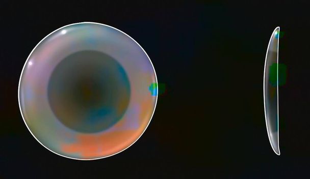 Correction of presbyopia: concentric simultaneous vision contact lens. - Zdjęcie, obraz