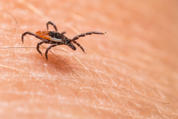 Closeup of running parasitic deer tick on textured human skin. Ixodes ricinus. Dangerous insect parasite in dynamic motion between hairs on blurry background. Carrier of encephalitis and Lyme disease. - Fotoğraf, Görsel