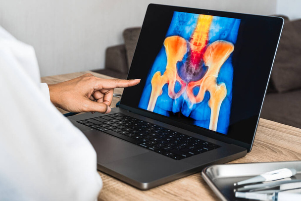 Doctor showing a x-ray of pain in the hips on a laptop. . High quality photo - 写真・画像
